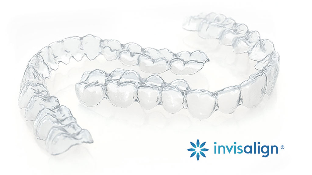 invisalign